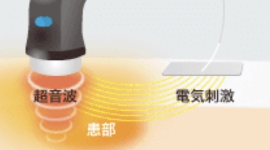 超音波機器「よう整骨院」